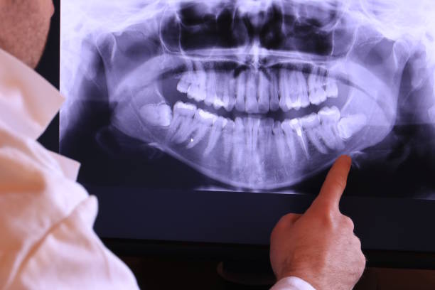 Best After-Hours Dental Trauma Care in Cherokee, IA