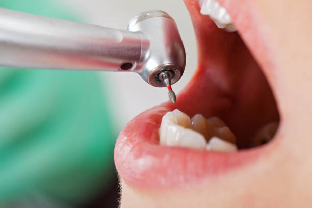 Best Emergency TMJ Treatment in Cherokee, IA